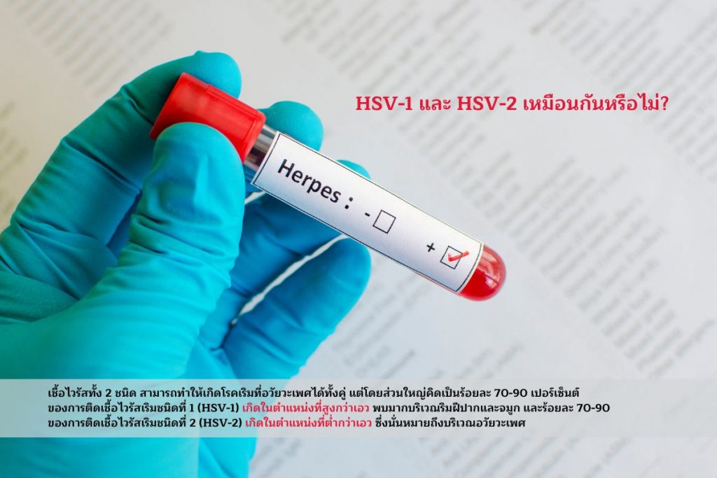 HSV-1 และ HSV-2 เหมือนกันหรือไม่
