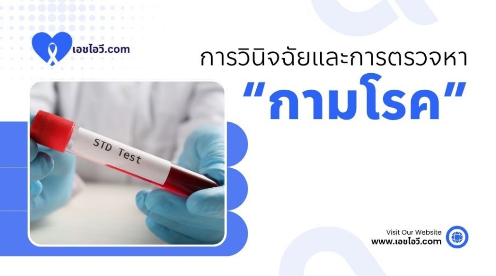 การวินิจฉัยและการตรวจหากามโรค